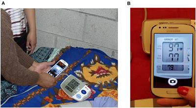 CNN-Based LCD Transcription of Blood Pressure From a Mobile Phone Camera